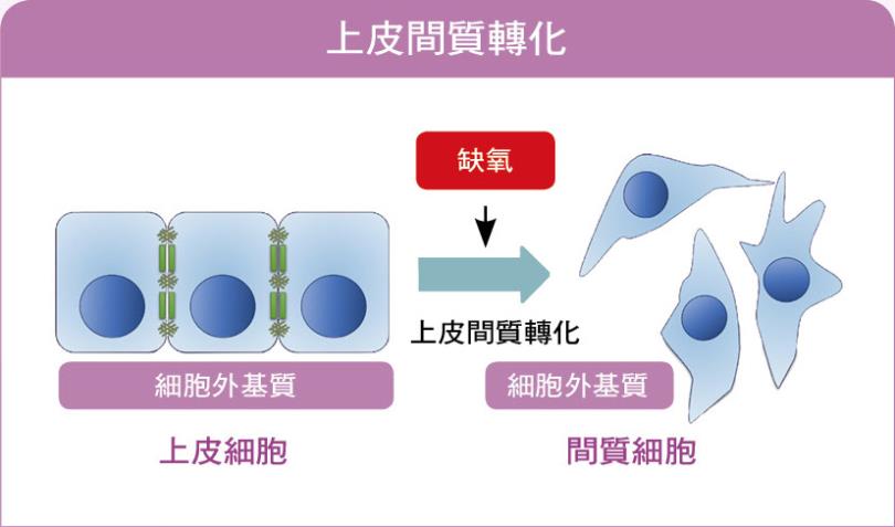 癌细胞的漂流旅程：癌症转移