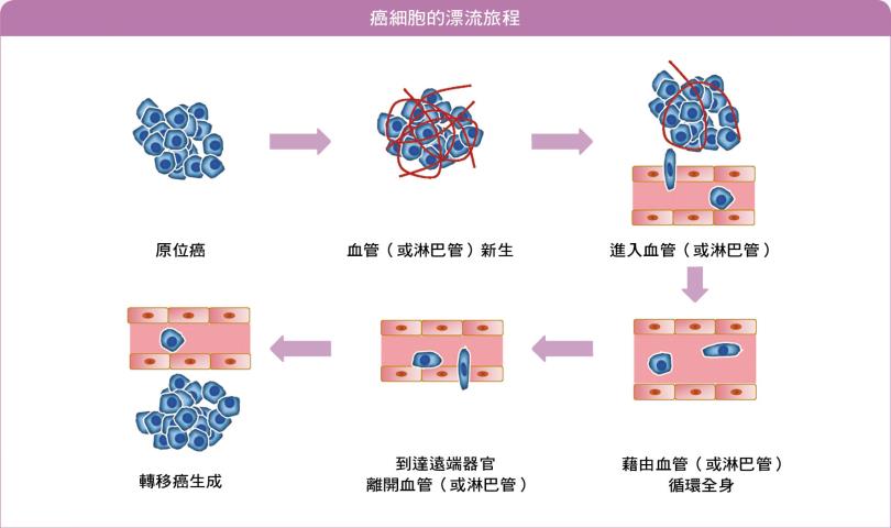 癌细胞的漂流旅程：癌症转移