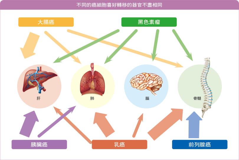 癌细胞的漂流旅程：癌症转移